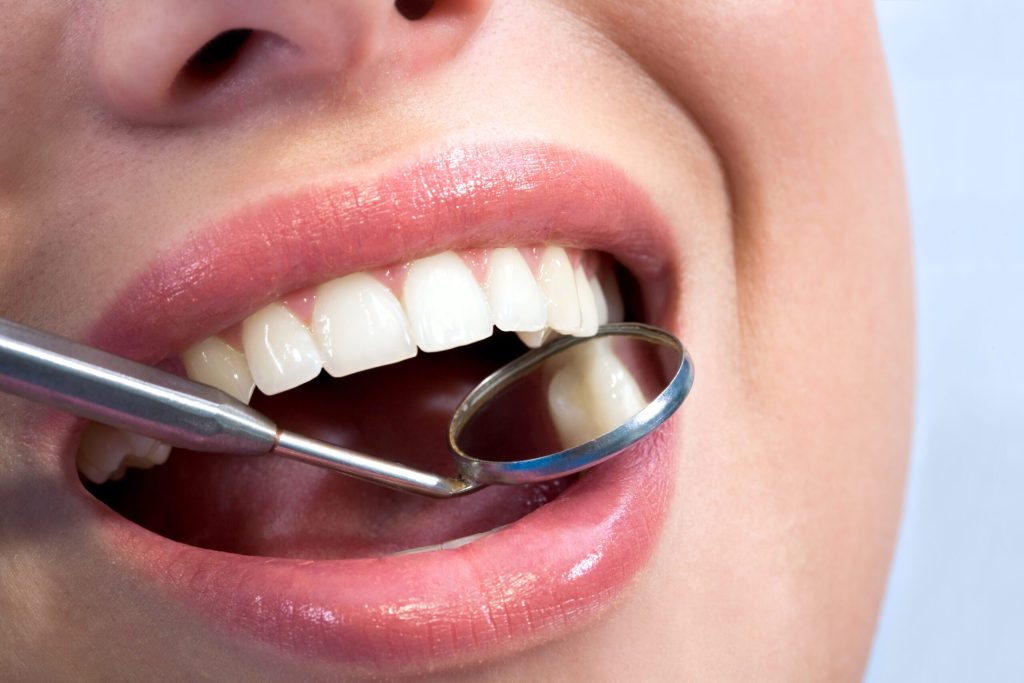 dental care