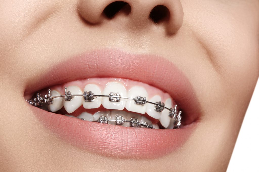 orthodontist in east los angeles