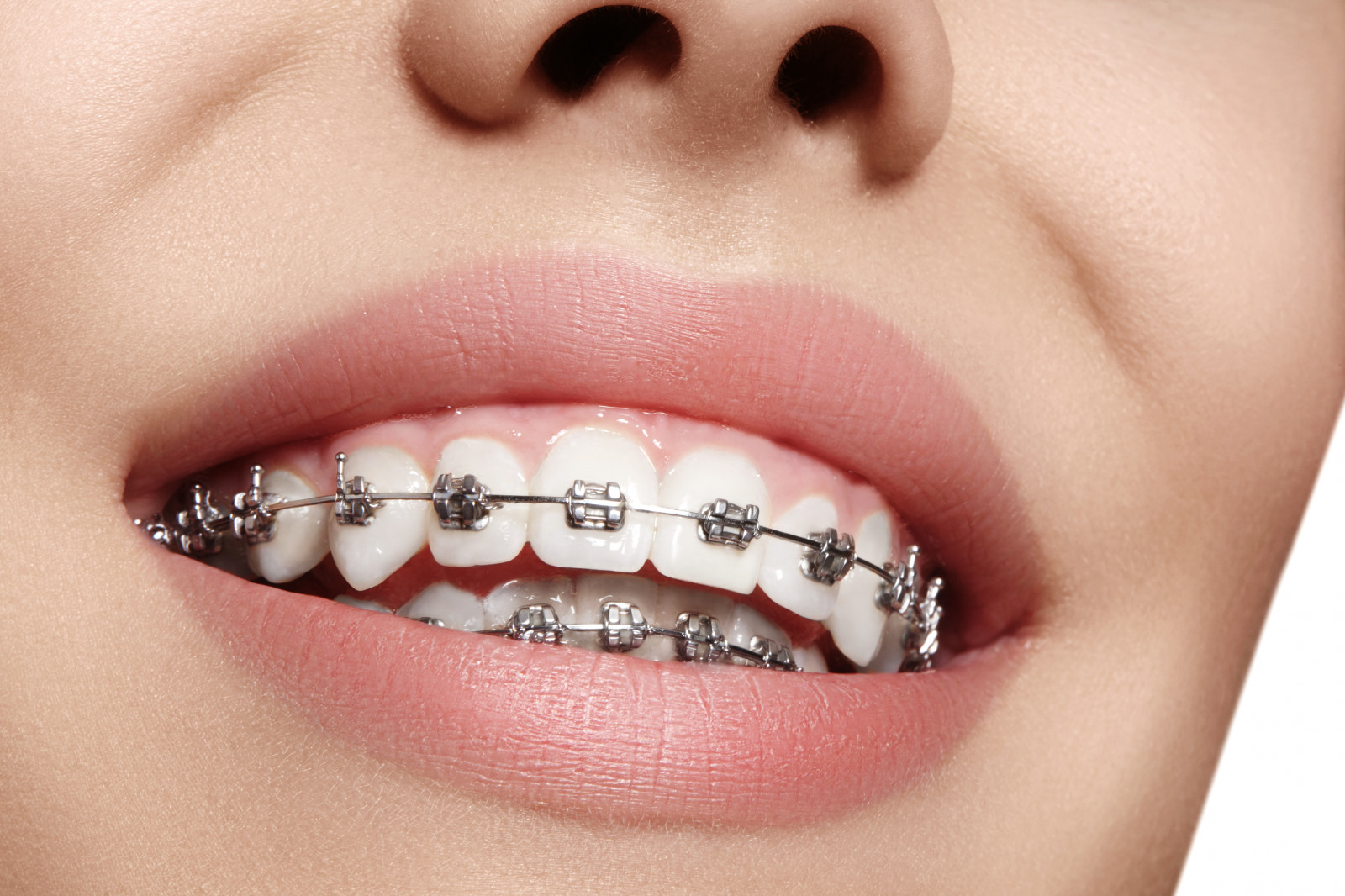 orthodontist in east los angeles